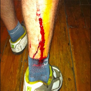 Danny's scarified calf